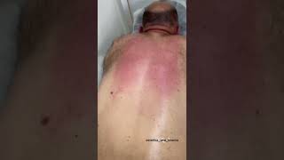 #Массаж #аппаратный Многопальчиковые насадки для различных задач. Оборот 3000 раз в минуту.