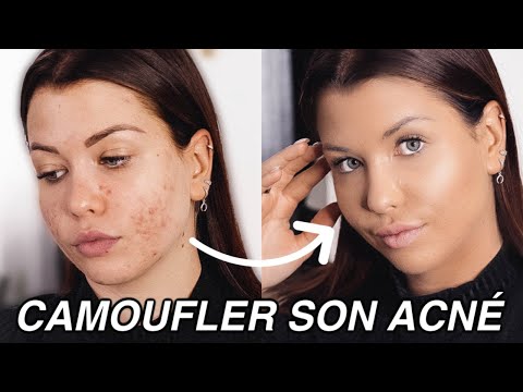 Vidéo: Comment Masquer Les Boutons Avec Du Maquillage