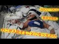 わこがNICU・GCUに入院することになったわけ【新生児仮死】