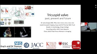 Tricuspid valve: past, present and future by Dr. Grapsa