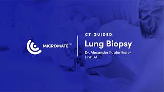 Micromate™ | CT-guided, Robotic-Assisted Lung Biopsy (Dr. Alexander Kupferthaler)