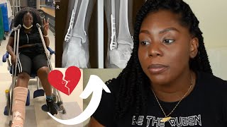 I broke my ankle on my  birthday (SURGERY & RECOVERY STORY) *Warning Graphic*