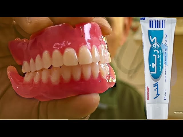 سر طريقة استخدام غراء طقم الاسنان التي يخفيها الاطباء - YouTube