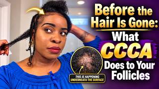What CCCA Does To Your Follicles...The Part of CCCA Alopecia Nobody Explained to Me