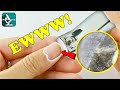FINGERNAIL (Dirty!) - Under The Microscope