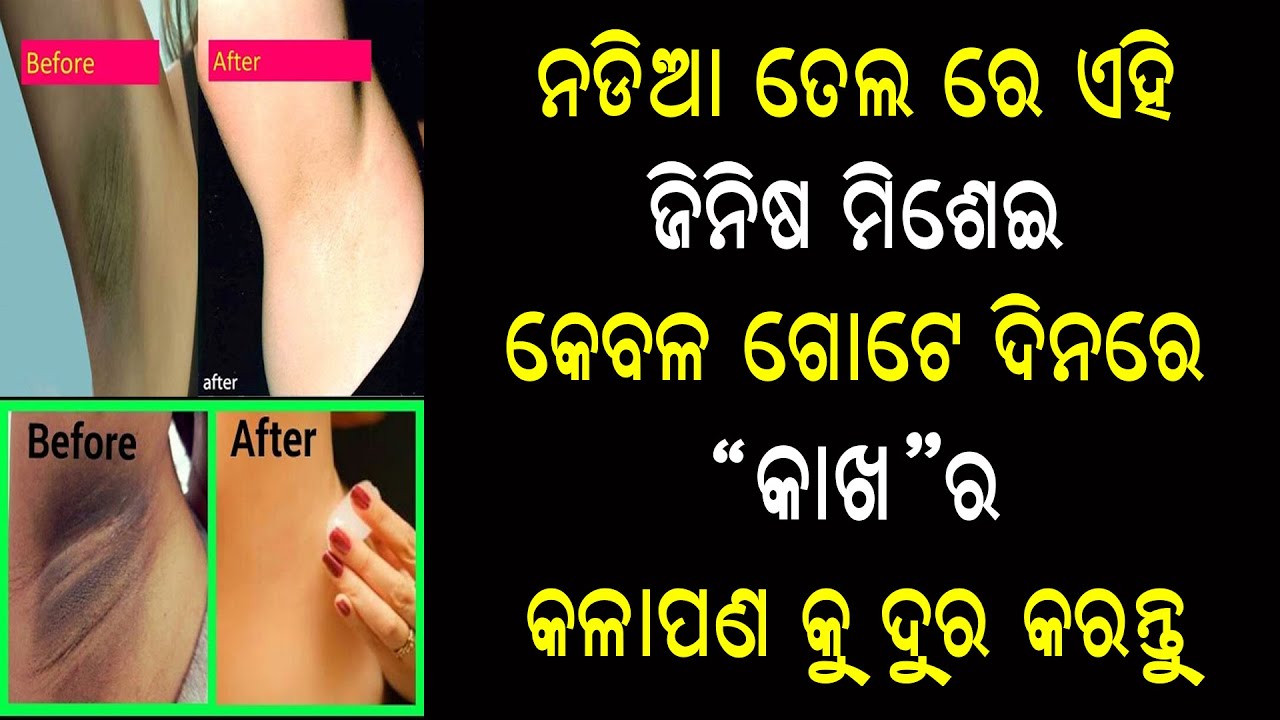 home remedies whitening underarms