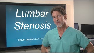 What is Lumbar Stenosis? Symptoms, Causes \& Benefits of Ultrasonic Technology
