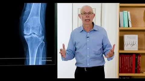 Biomechanics of Movement | Lecture 13.2:  Personalized Biomechanics for People with Osteoarthritis