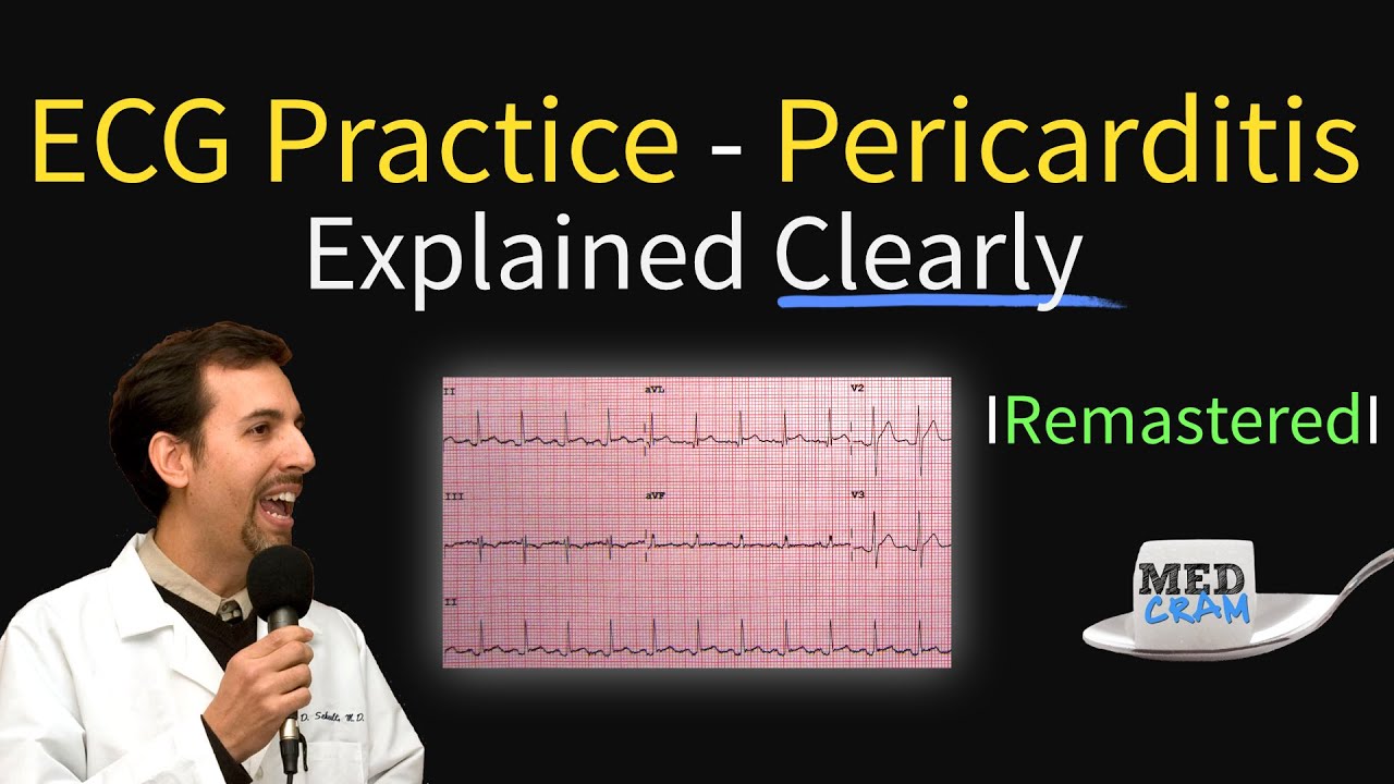Medcram Medical Lectures Explained Clearly Youtube Ecg Interpretation Interpretation Lecture [ 720 x 1280 Pixel ]