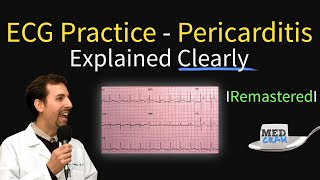 ECG Interpretation Practice - Pericarditis on EKG Explained!