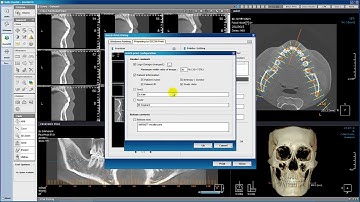 Xelis Dental Case Tutorial Batch