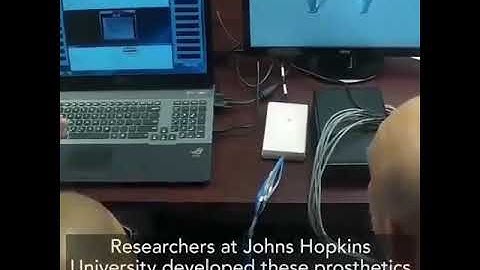 🦾 Mind Controlled Robotic Arm For The Disabled