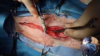 Thyroid carcinoma in a dog - audio fixed at 8:30 minutes.