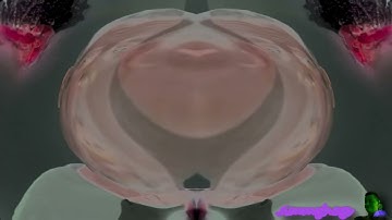 (RQ) Preview 2 Michael Rosen Effects in G-Major 169 (G-Major 82 + G-Major 87 Version)