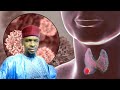 YADDA ZAMU MAGANCE MATSALAR CIWAN MAKOKO Wato Thyroid CIKIN YAN KWANAKI