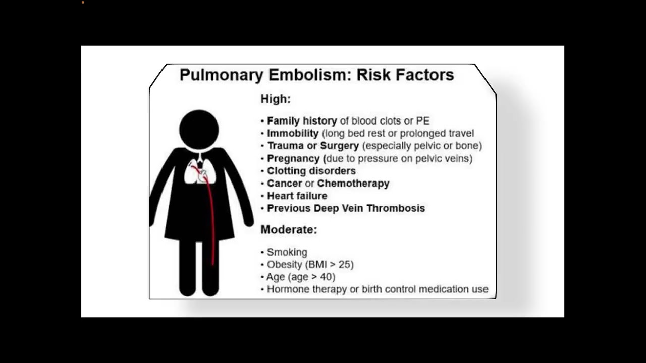 Pulmonary Embolism Misdiagnosed As Hysteria or Panic Attack | Fatal Mistake !
