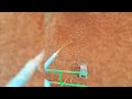 Hydroseeding Machine | Yugong Machinery