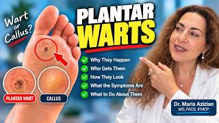 Plantar Warts: Why They Happen, How to Recognize Them & Treatment Options