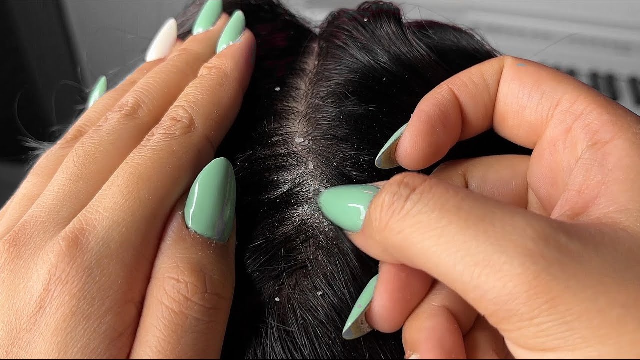 Aggressive Dandruff Removal + Hair Brushing & Scalp Scratching ASMR