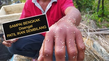 Sampai bengkak kena patil ikan sembilang
