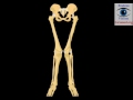 Jambes dformes  en genu valgum chez lenfant malformation des genoux