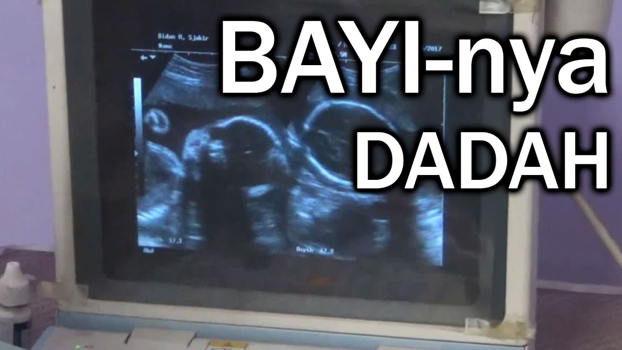 Waktu Hamil Usg Bulan Ke 6 Bidan Sjakir Tegal Naffa Annahdo 