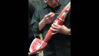 Blood vessels and lymphatic system: ARM