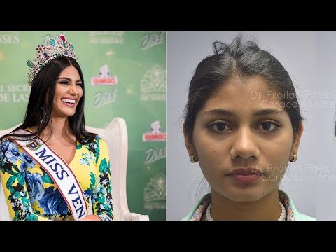 Video: Venezuela Darf Nicht Zum Miss Universe Gehen