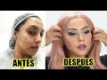 Botox y Ácido Hialuronico MI EXPERIENCIA / Alin Pescina Makeup