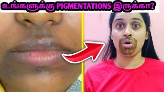 உங்களுக்கு PIGMENTATION PROBLEM இருக்கா?DO THIS 3 STEPS100%Natural RemedyTamilBeautyBeats