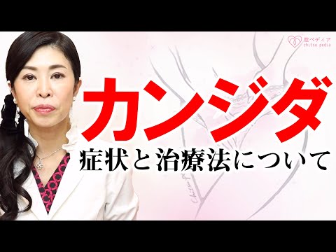 【医師監修】カンジダの症状と治療法について