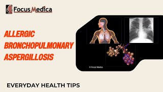 Allergic bronchopulmonary aspergillosis (ABPA)