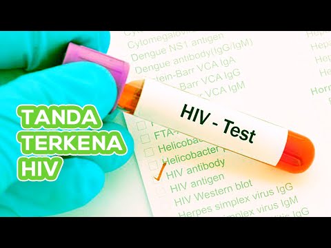 Video: Mengapa hiv tidak dapat dikesan?