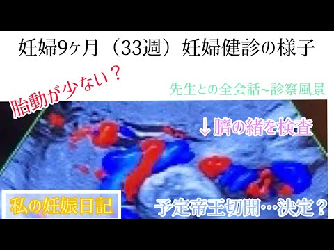 私の妊娠日記【妊娠9ヶ月（33週）】妊婦検診の様子〜胎動が少なくて心配…（臍の緒検査あり）