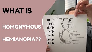 What is Homonymous Hemianopia?