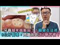 【牙齒越來越脆弱？！關鍵在這裡 8位牙醫曝：問題出在這3個習慣！】