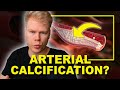 Do Calcium Supplements Cause Arterial Plaque & Heart Attacks?