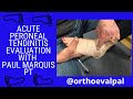 Acute Peroneal Tendinitis Evaluation with @OrthoEvalPal