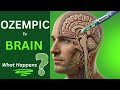 What OZEMPIC actually does to the BRAIN |   OZEMPIC - BRAIN