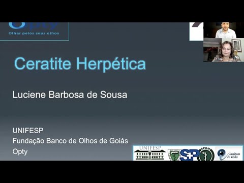 Aula Herpes Ocular /Ceratite Herpética  • Dra Luciene Barbosa