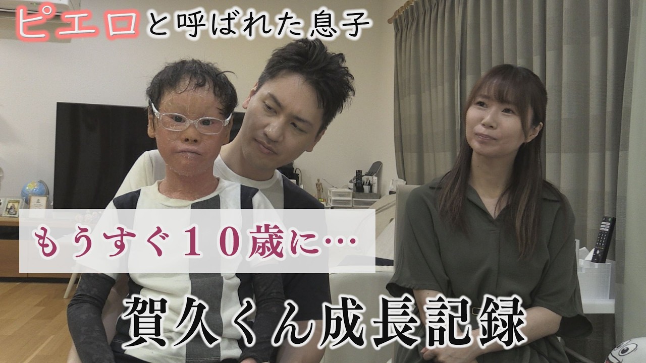 【最新話】驚きの言葉も！大きくなった賀久くん～難病・道化師様魚鱗癬と闘う～配信型ドキュメンタリー「ピエロと呼ばれた息子」第１４４話