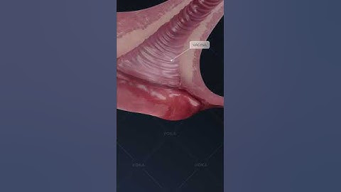 What is BARTHOLINITIS and how does it affect the vaginal area? Explore gynecology in 3D with VOKA