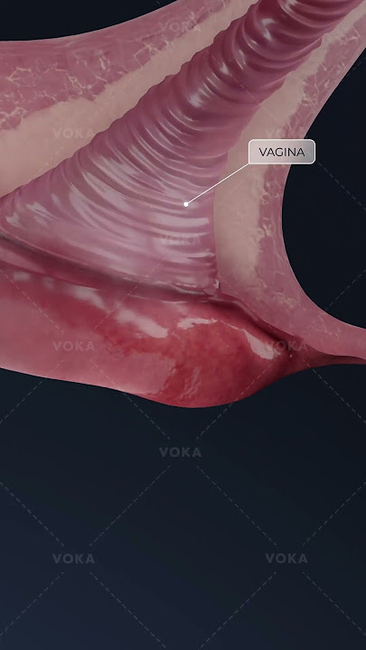 What is BARTHOLINITIS and how does it affect the vaginal area? Explore gynecology in 3D with VOKA