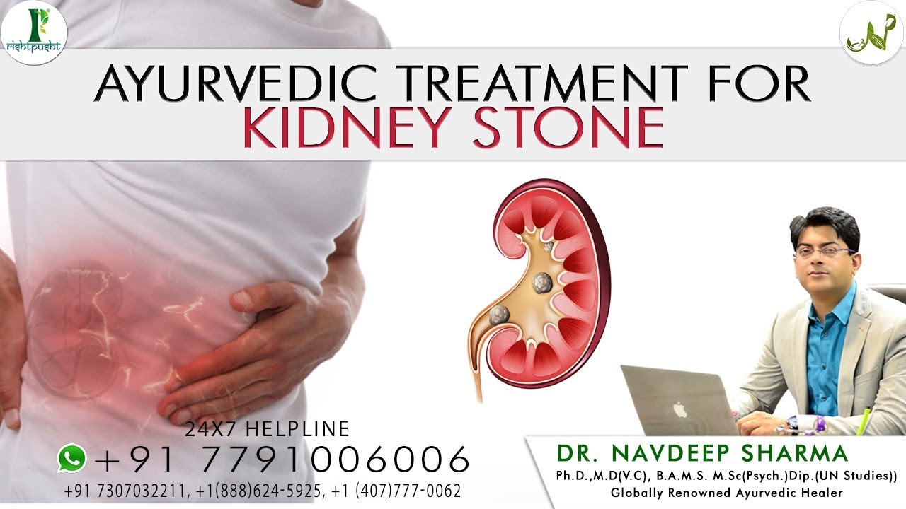 🔴(Live) Ayurvedic Treatment For Kidney Stone Kidney Stone Treatment