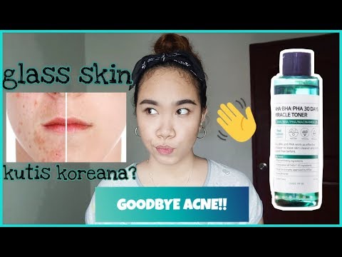 Goodbye Acne!  days Miracle toner Review Update (th day of using)