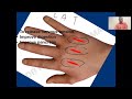 Day 2  15 day acupressure therapy certification course treat diabetes  dr hemanth kumar sharma