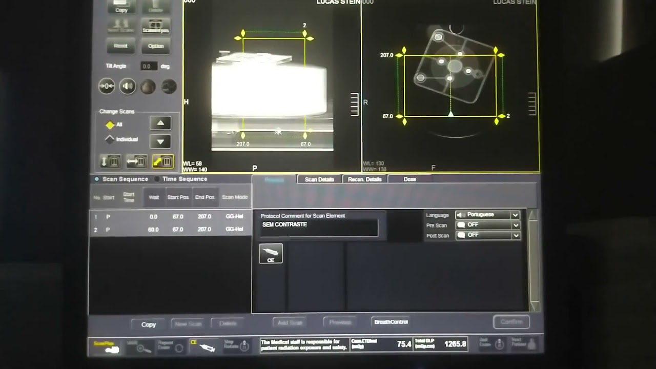 Como realizar Tomografia ? #video02