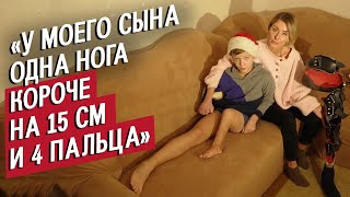 видео: У моего сына аномалия ноги: Ира | Быть мамой картинка: У моего сына аномалия ноги: Ира | Быть мамой