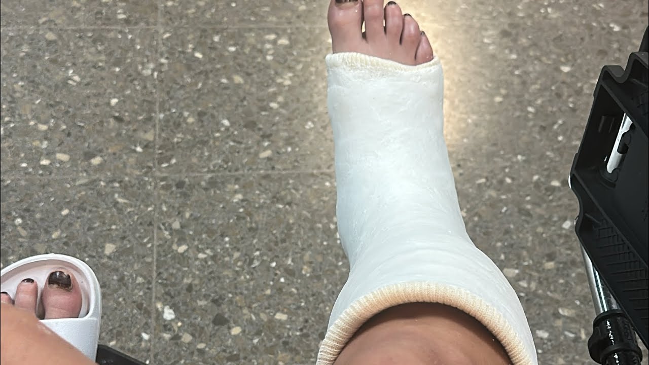 Mi peor accidente del año… hay que resurgir 🇨🇷