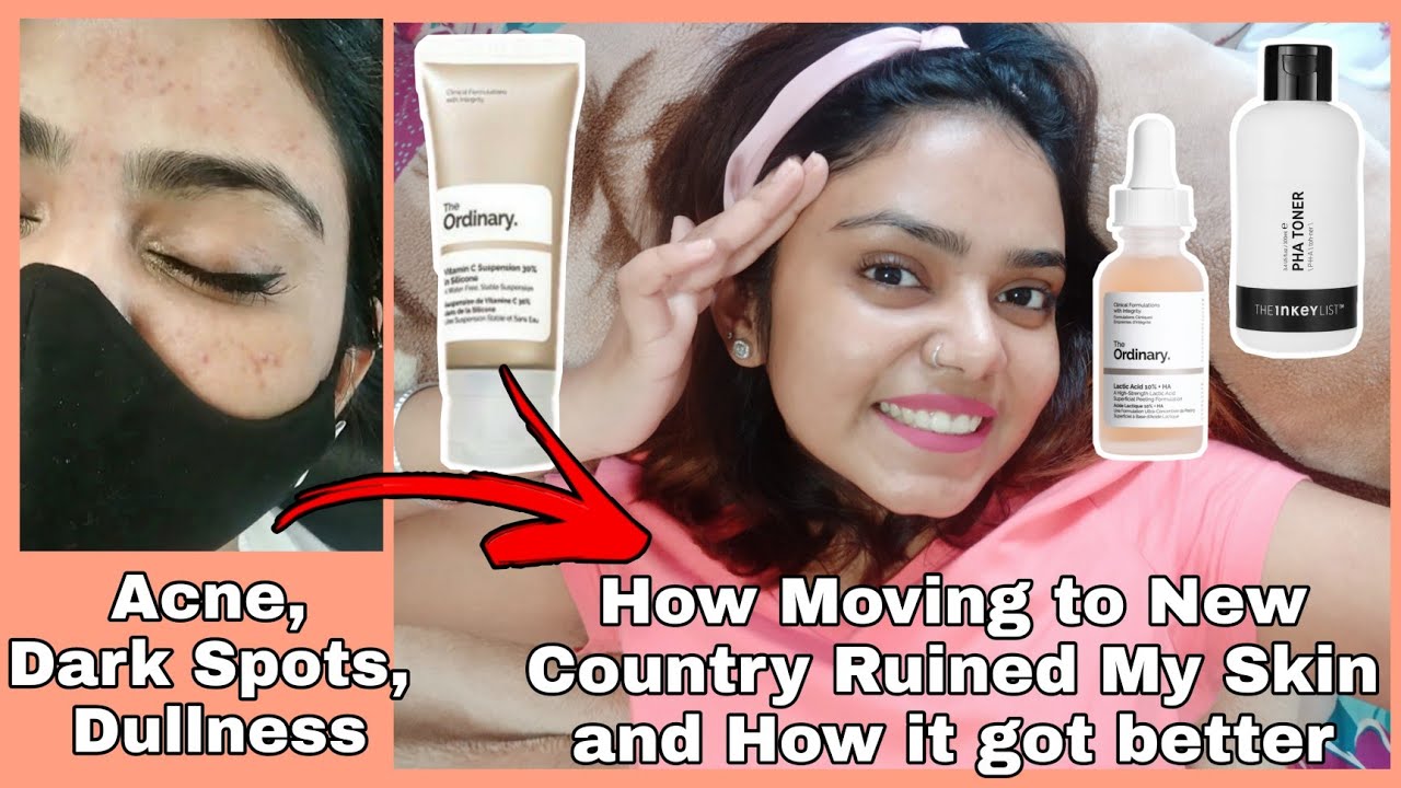 Daily Chemical Exfoliation at Home The Ordinary Lactic Acid & The Inkey List PHA Toner Review